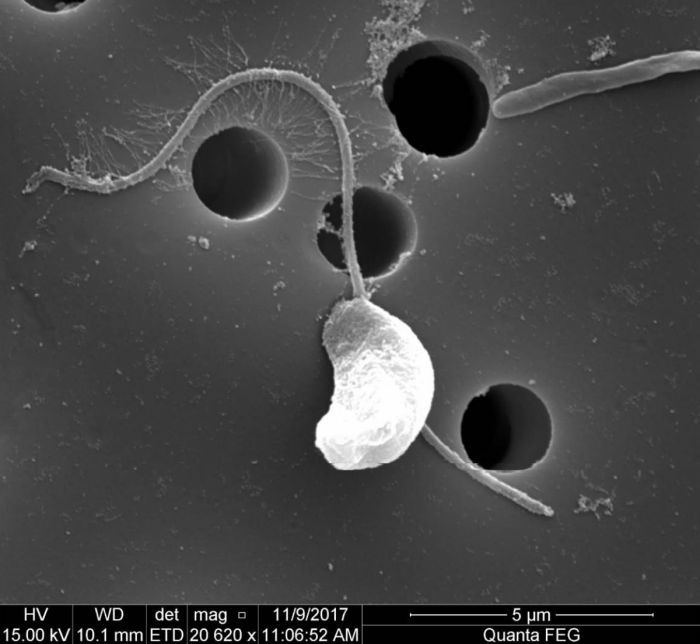 Eine schwarz-weiß Mikroskopaufnahme eines bohnenförmigen Einzellers mit einer langen Geissel.