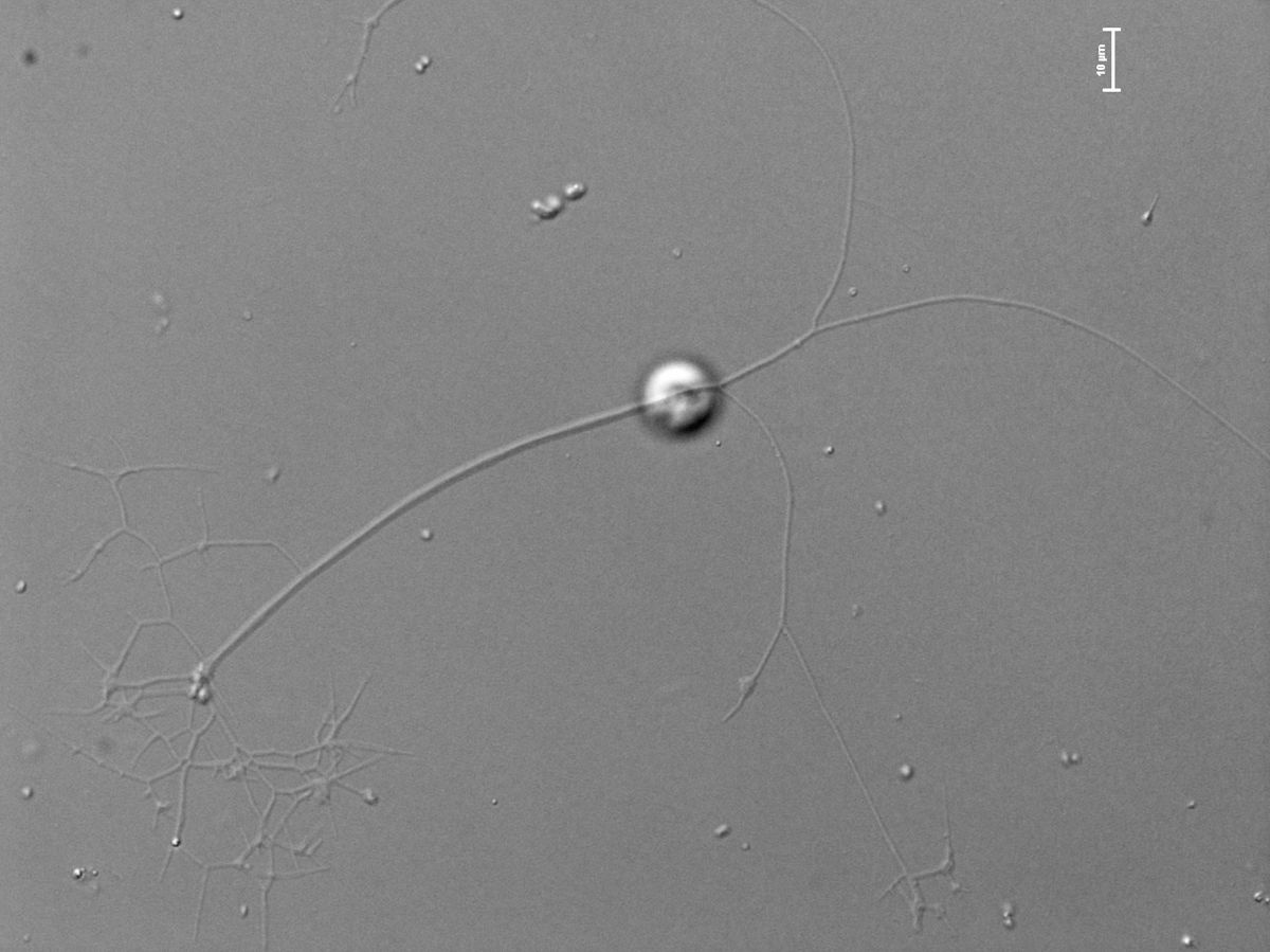 Eine Mikroskopaufnahme zeigt lange verzweige Fäden.